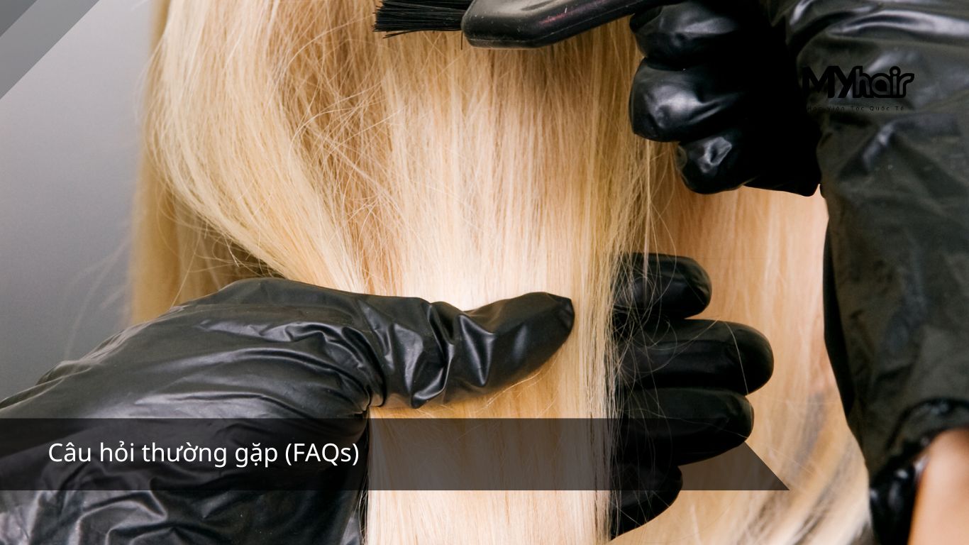 Câu hỏi thường gặp (FAQs)