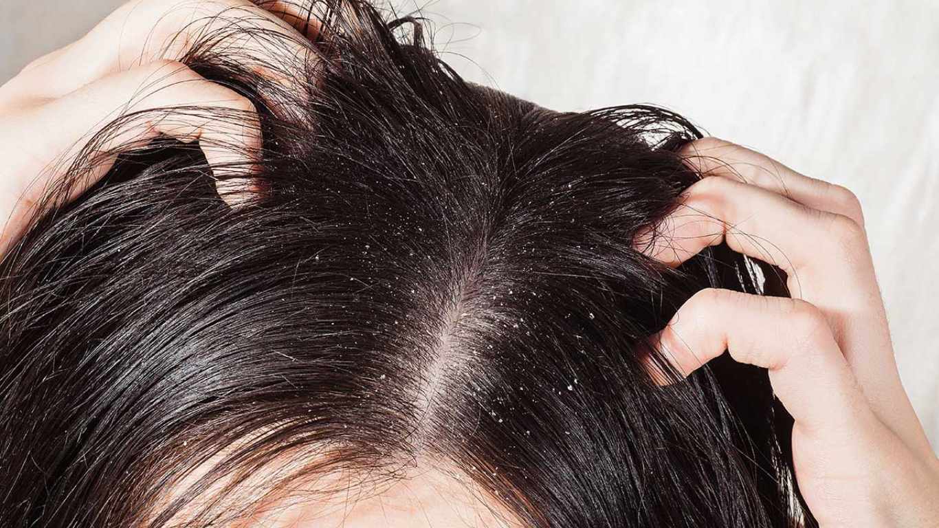 Cách nhận biết tóc dầu