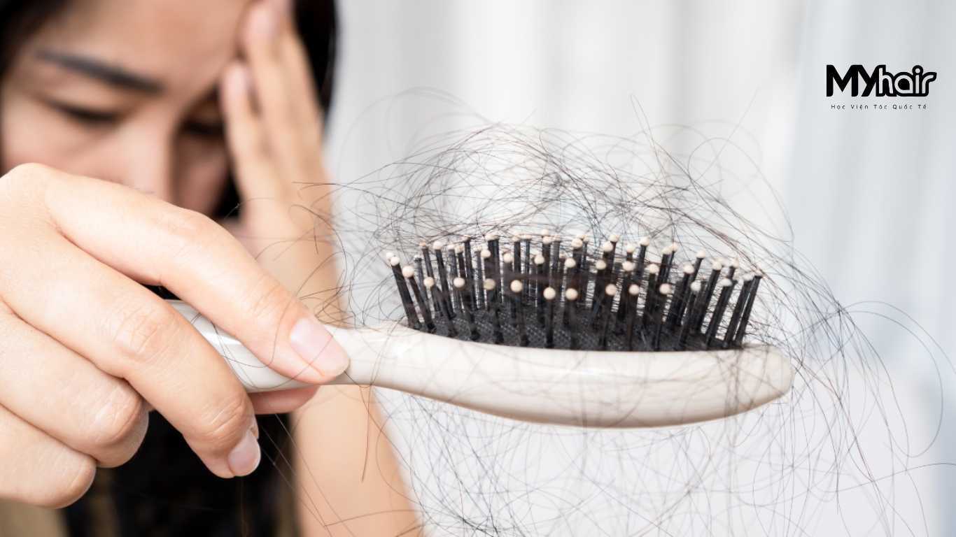 Những nguyên nhân gây rụng tóc phổ biến