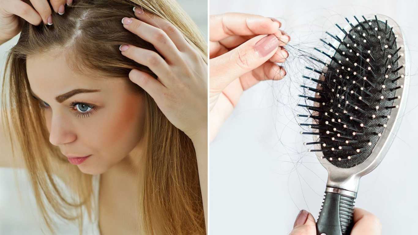 Rụng tóc là gì? Khi nào được xem là rụng tóc bất thường?