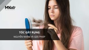 Tóc gãy rụng - Nguyên nhân và giải pháp