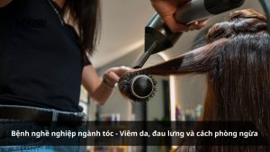 Bệnh nghề nghiệp ngành tóc - Viêm da, đau lưng và cách phòng ngừa
